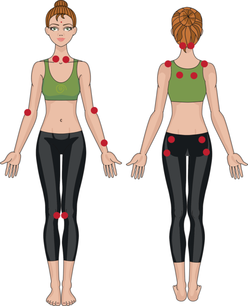 tender pont fibromialgia